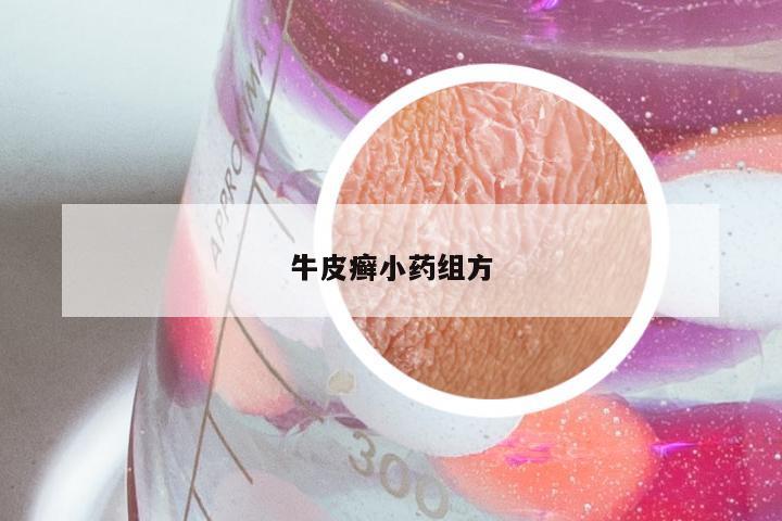 牛皮癣小药组方