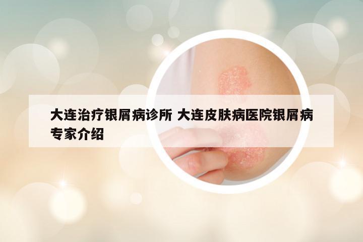 大连治疗银屑病诊所 大连皮肤病医院银屑病专家介绍