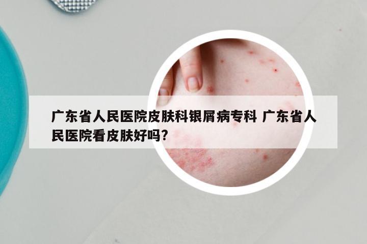广东省人民医院皮肤科银屑病专科 广东省人民医院看皮肤好吗?