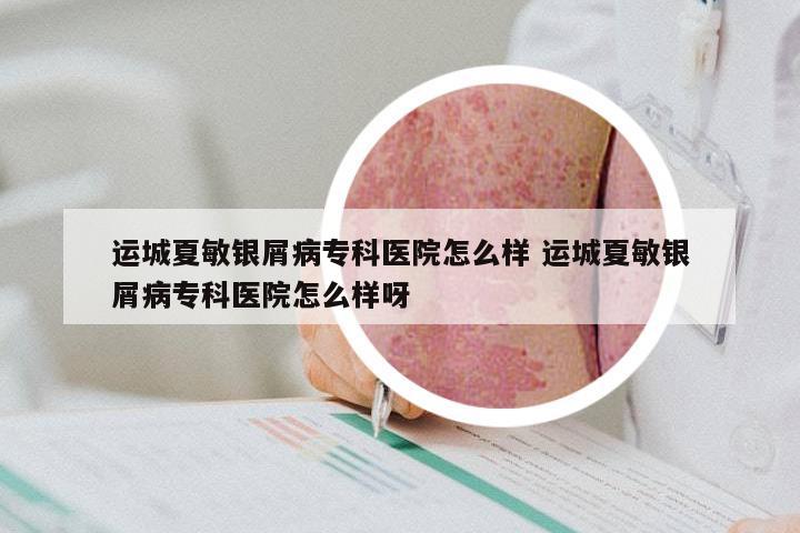 运城夏敏银屑病专科医院怎么样 运城夏敏银屑病专科医院怎么样呀