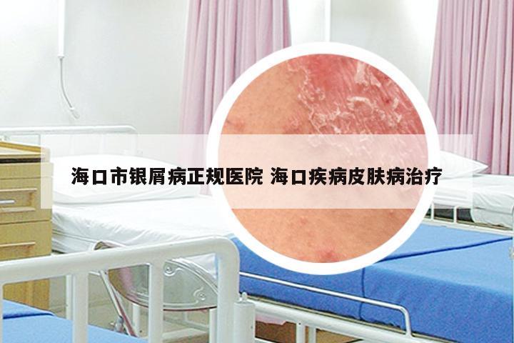 海口市银屑病正规医院 海口疾病皮肤病治疗