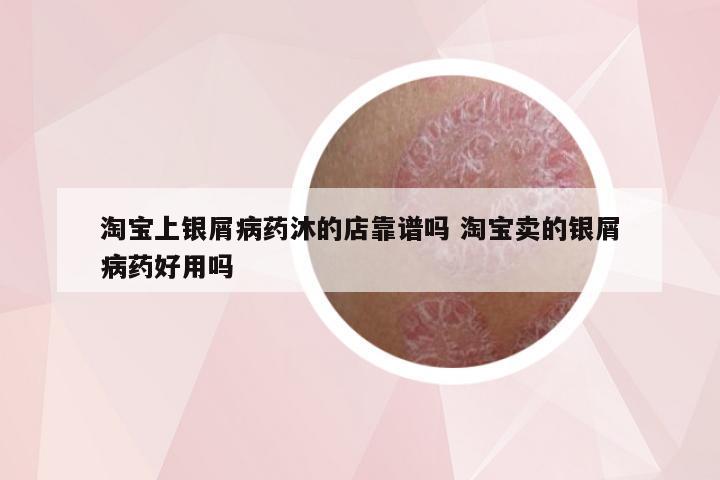 淘宝上银屑病药沐的店靠谱吗 淘宝卖的银屑病药好用吗