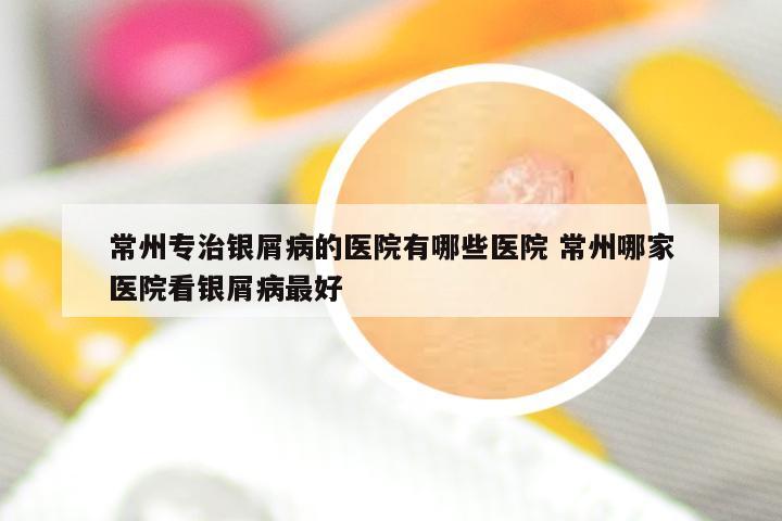 常州专治银屑病的医院有哪些医院 常州哪家医院看银屑病最好
