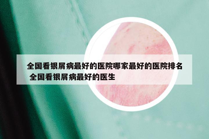 全国看银屑病最好的医院哪家最好的医院排名 全国看银屑病最好的医生