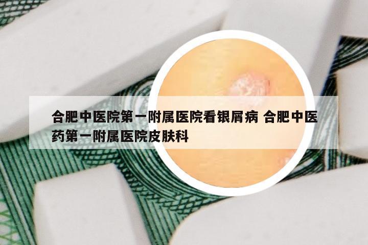 合肥中医院第一附属医院看银屑病 合肥中医药第一附属医院皮肤科