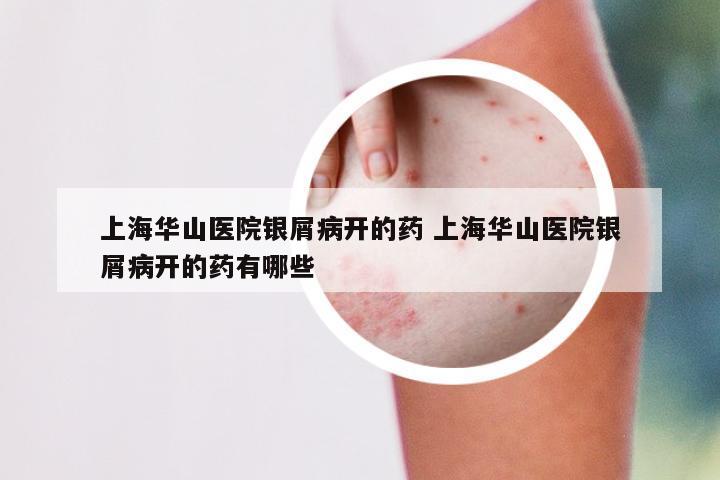 上海华山医院银屑病开的药 上海华山医院银屑病开的药有哪些