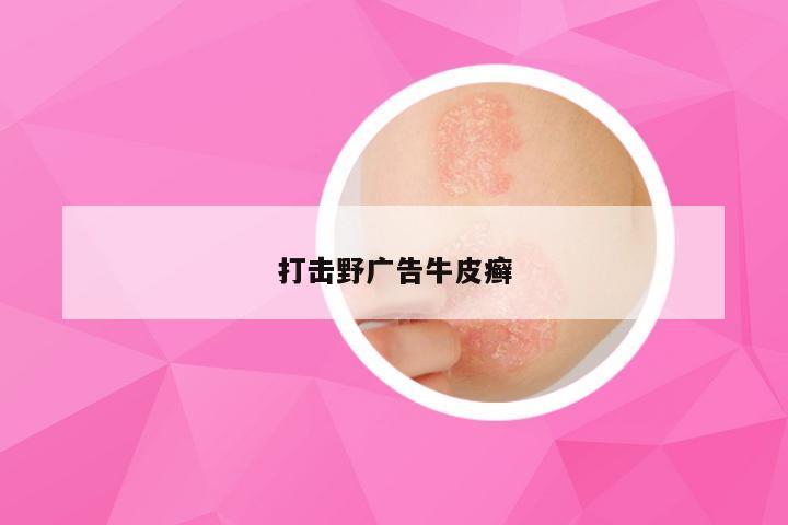 打击野广告牛皮癣