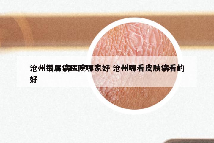 沧州银屑病医院哪家好 沧州哪看皮肤病看的好