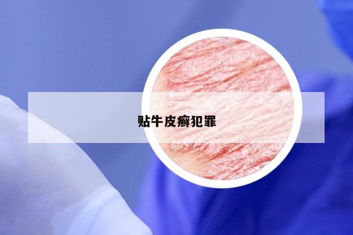 贴牛皮癣犯罪