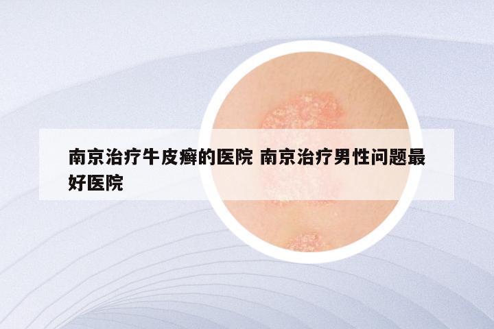 南京治疗牛皮癣的医院 南京治疗男性问题最好医院