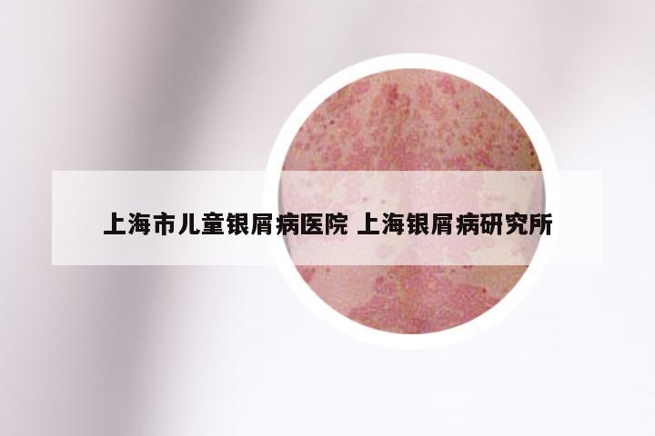 上海市儿童银屑病医院 上海银屑病研究所