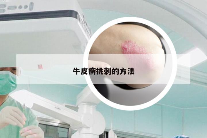 牛皮癣挑刺的方法