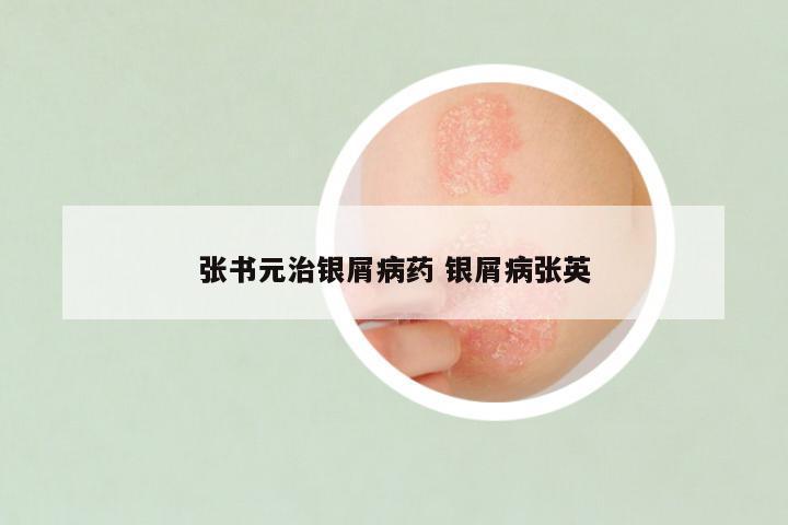 张书元治银屑病药 银屑病张英