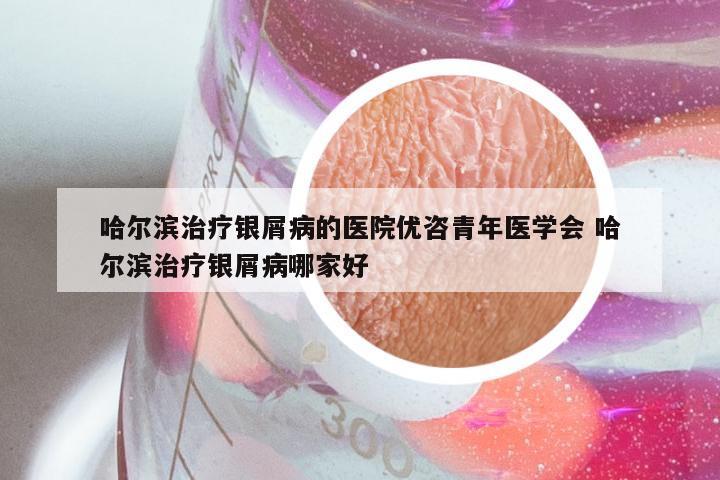哈尔滨治疗银屑病的医院优咨青年医学会 哈尔滨治疗银屑病哪家好