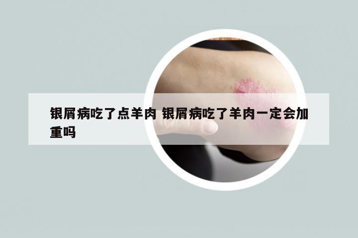 银屑病吃了点羊肉 银屑病吃了羊肉一定会加重吗