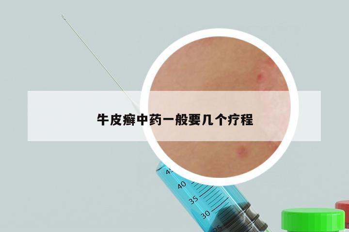 牛皮癣中药一般要几个疗程