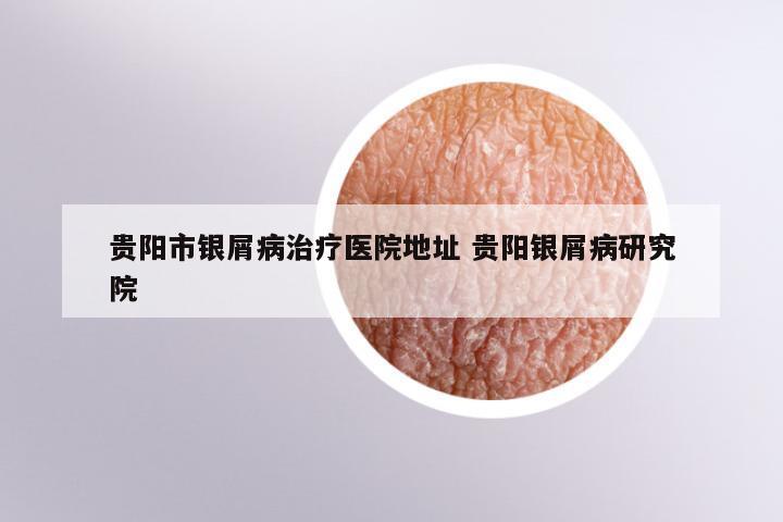 贵阳市银屑病治疗医院地址 贵阳银屑病研究院