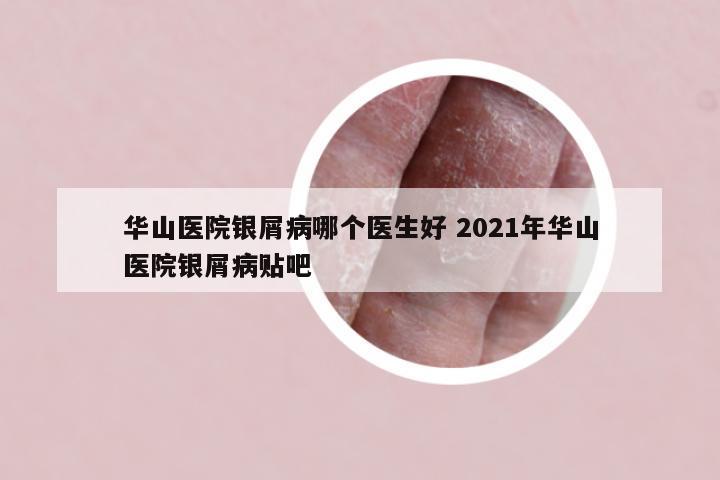 华山医院银屑病哪个医生好 2021年华山医院银屑病贴吧