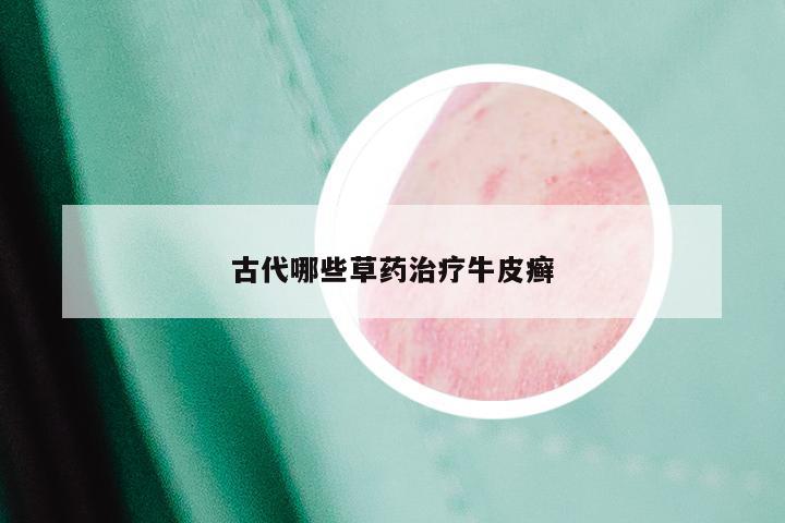 古代哪些草药治疗牛皮癣