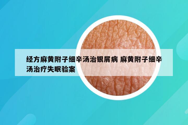 经方麻黄附子细辛汤治银屑病 麻黄附子细辛汤治疗失眠验案