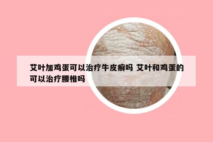 艾叶加鸡蛋可以治疗牛皮癣吗 艾叶和鸡蛋的可以治疗腰椎吗