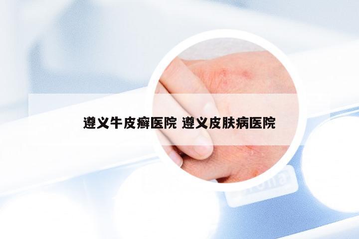 遵义牛皮癣医院 遵义皮肤病医院