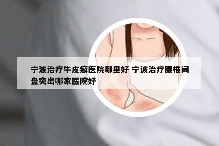 宁波治疗牛皮癣医院哪里好 宁波治疗腰椎间盘突出哪家医院好