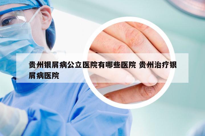 贵州银屑病公立医院有哪些医院 贵州治疗银屑病医院