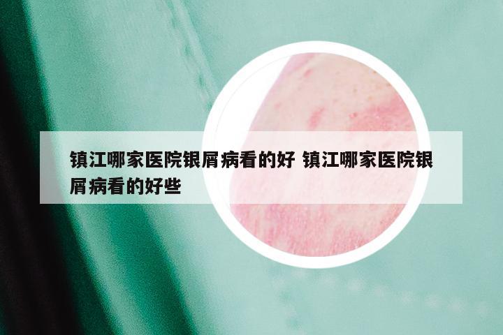 镇江哪家医院银屑病看的好 镇江哪家医院银屑病看的好些