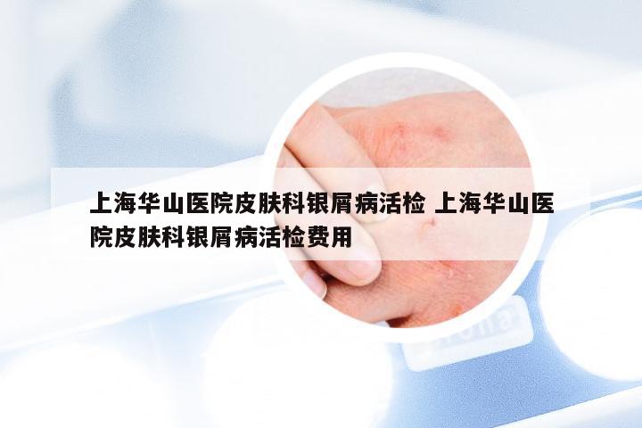 上海华山医院皮肤科银屑病活检 上海华山医院皮肤科银屑病活检费用