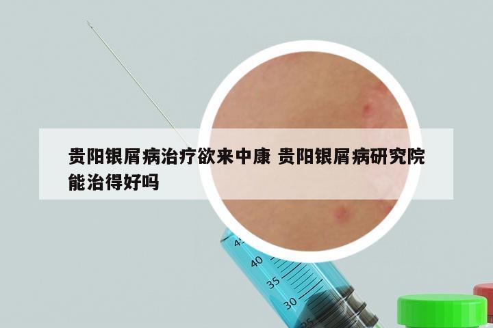 贵阳银屑病治疗欲来中康 贵阳银屑病研究院能治得好吗