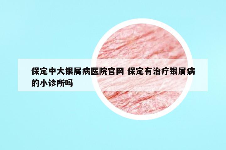 保定中大银屑病医院官网 保定有治疗银屑病的小诊所吗