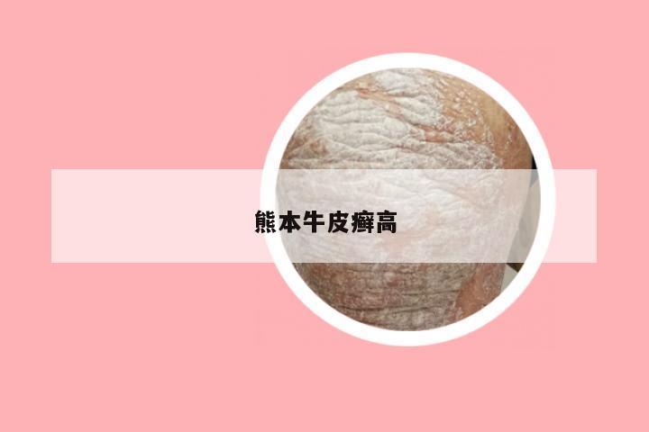 熊本牛皮癣高