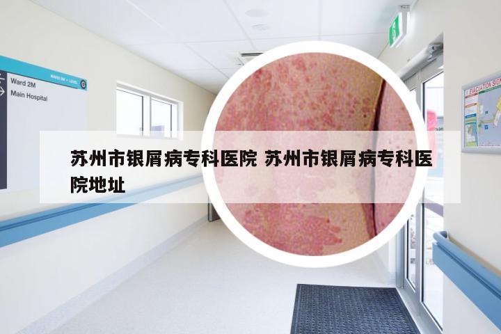 苏州市银屑病专科医院 苏州市银屑病专科医院地址