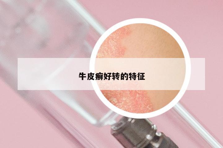 牛皮癣好转的特征