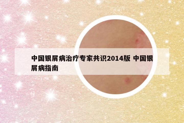 中国银屑病治疗专家共识2014版 中国银屑病指南