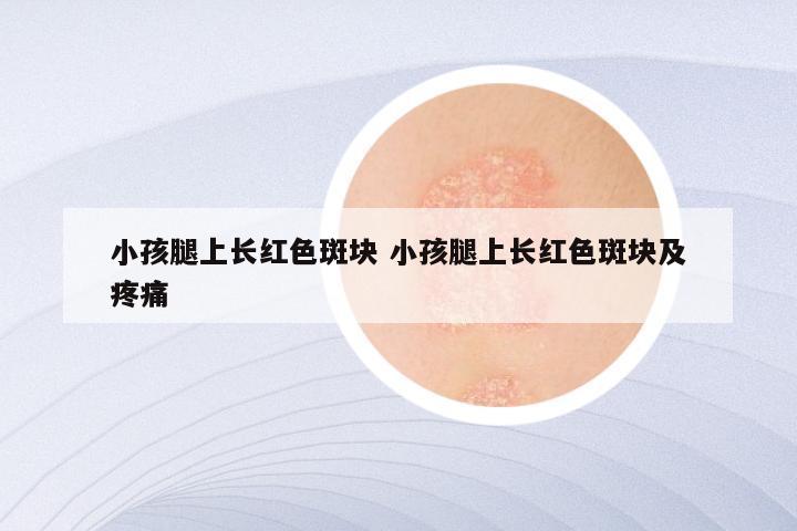 小孩腿上长红色斑块 小孩腿上长红色斑块及疼痛