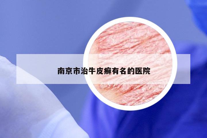 南京市治牛皮癣有名的医院