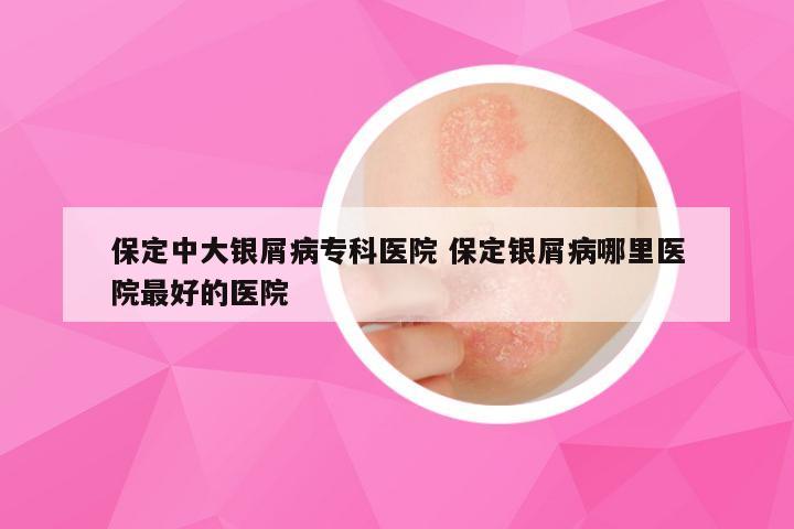 保定中大银屑病专科医院 保定银屑病哪里医院最好的医院