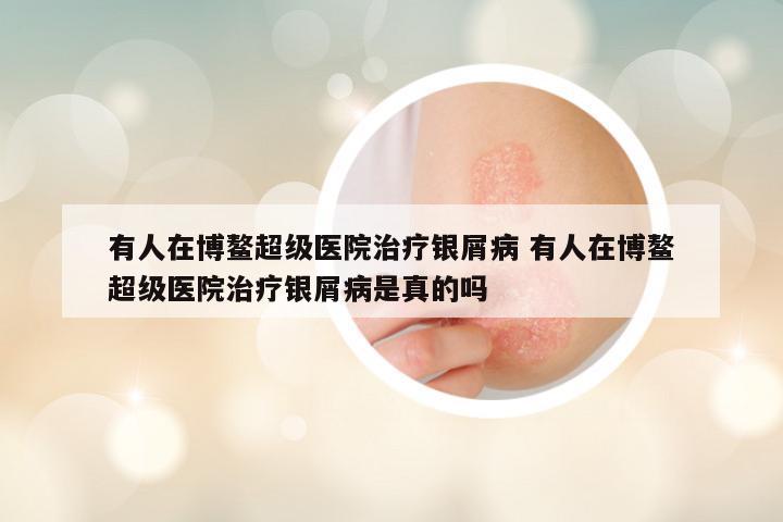 有人在博鳌超级医院治疗银屑病 有人在博鳌超级医院治疗银屑病是真的吗