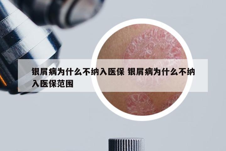 银屑病为什么不纳入医保 银屑病为什么不纳入医保范围