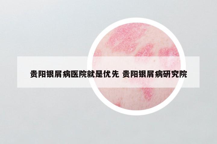 贵阳银屑病医院就是优先 贵阳银屑病研究院