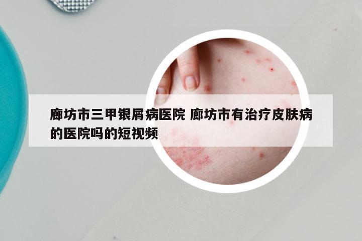 廊坊市三甲银屑病医院 廊坊市有治疗皮肤病的医院吗的短视频