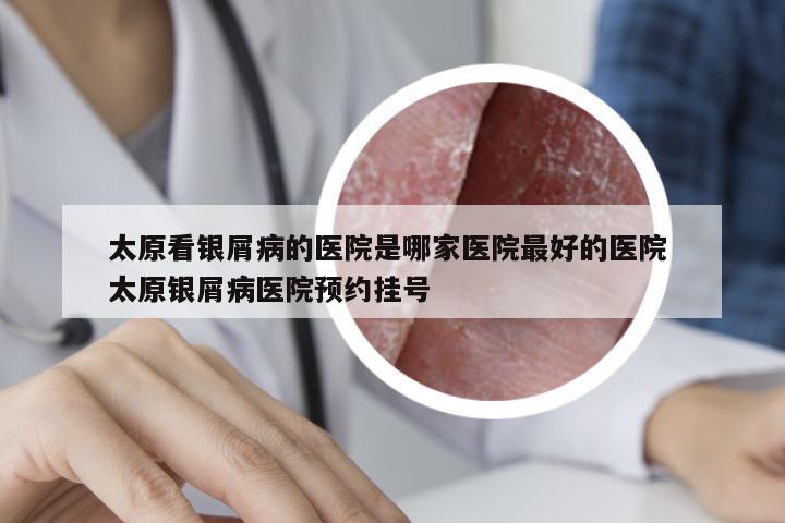 太原看银屑病的医院是哪家医院最好的医院 太原银屑病医院预约挂号