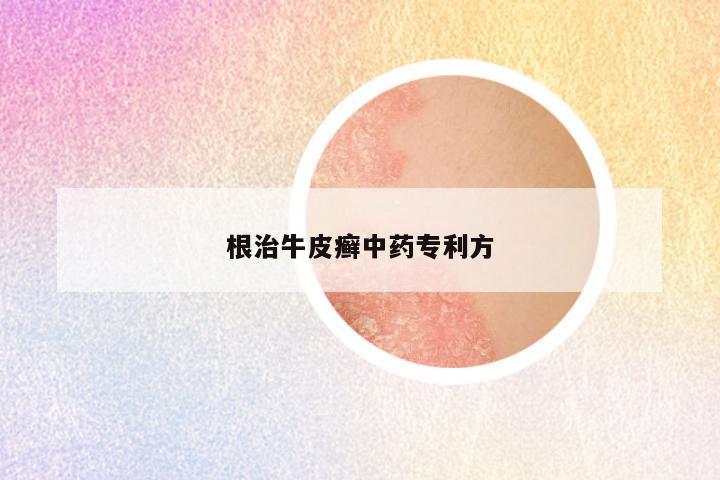 根治牛皮癣中药专利方