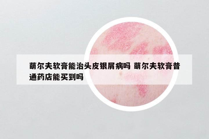 萌尔夫软膏能治头皮银屑病吗 萌尔夫软膏普通药店能买到吗