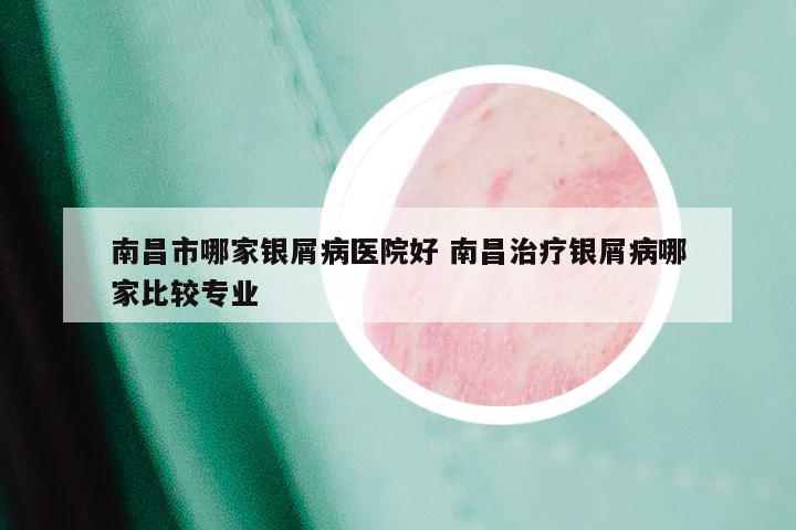 南昌市哪家银屑病医院好 南昌治疗银屑病哪家比较专业
