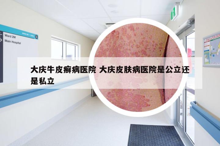 大庆牛皮癣病医院 大庆皮肤病医院是公立还是私立