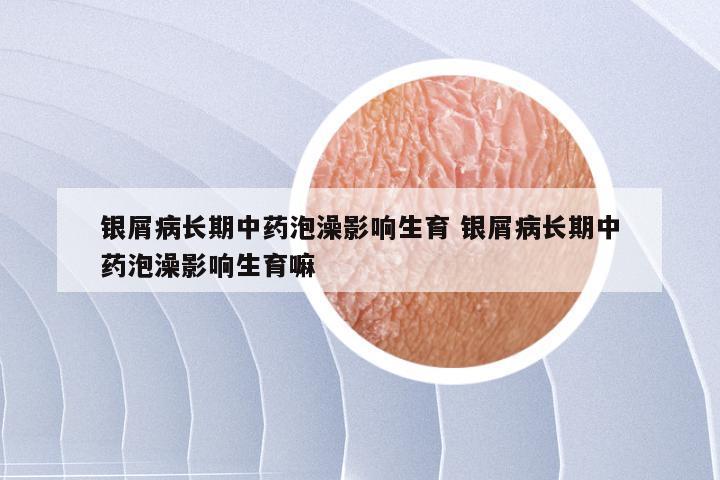 银屑病长期中药泡澡影响生育 银屑病长期中药泡澡影响生育嘛