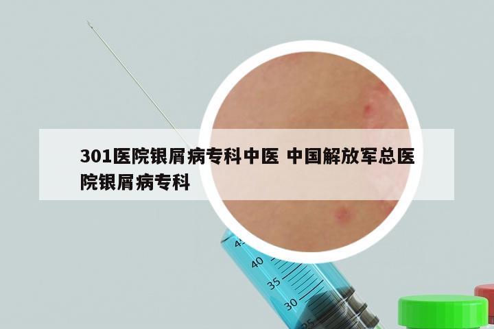 301医院银屑病专科中医 中国解放军总医院银屑病专科